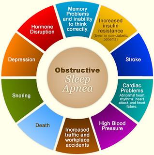 υπνική άπνοια
