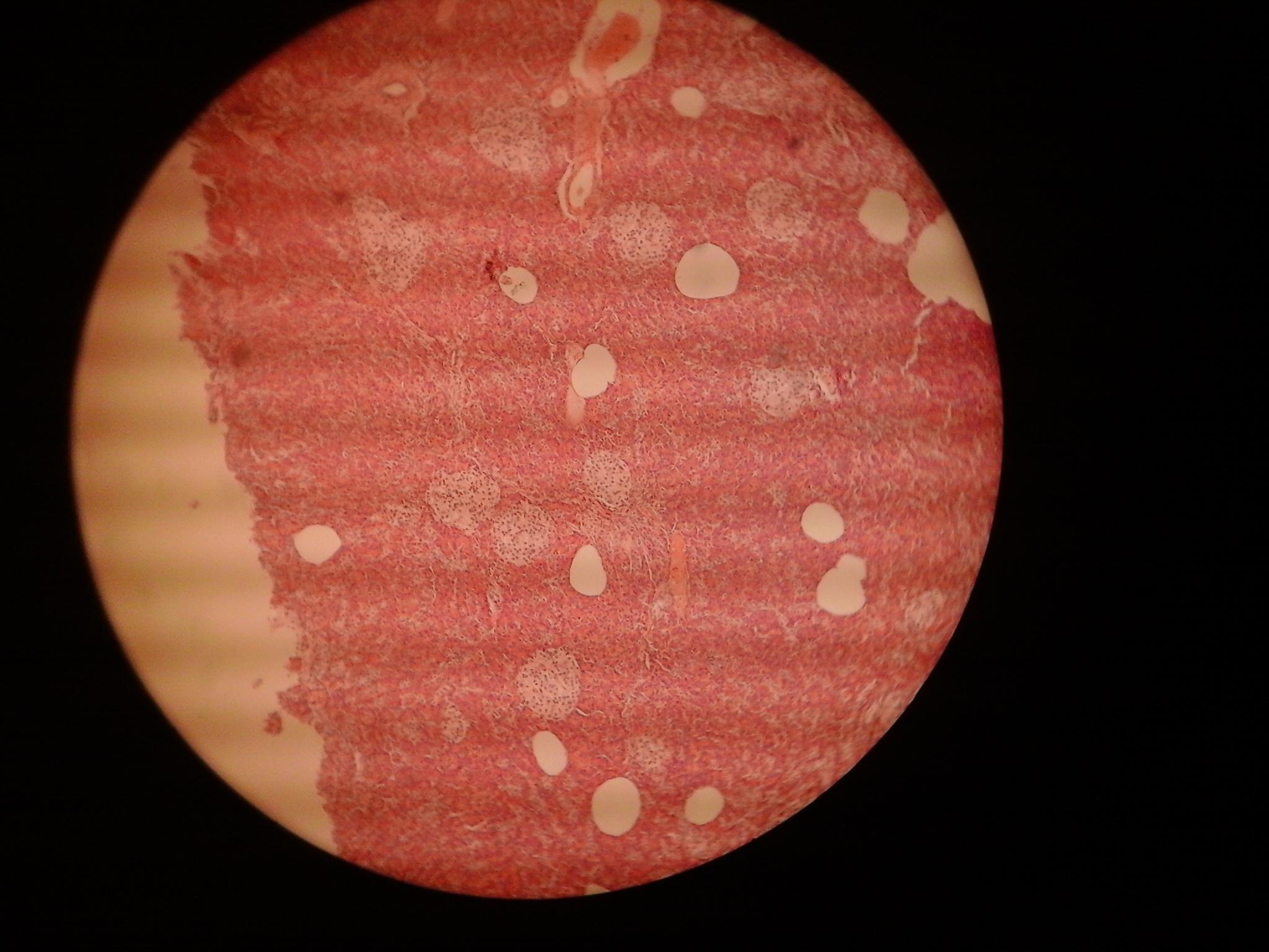 παγκρέατος